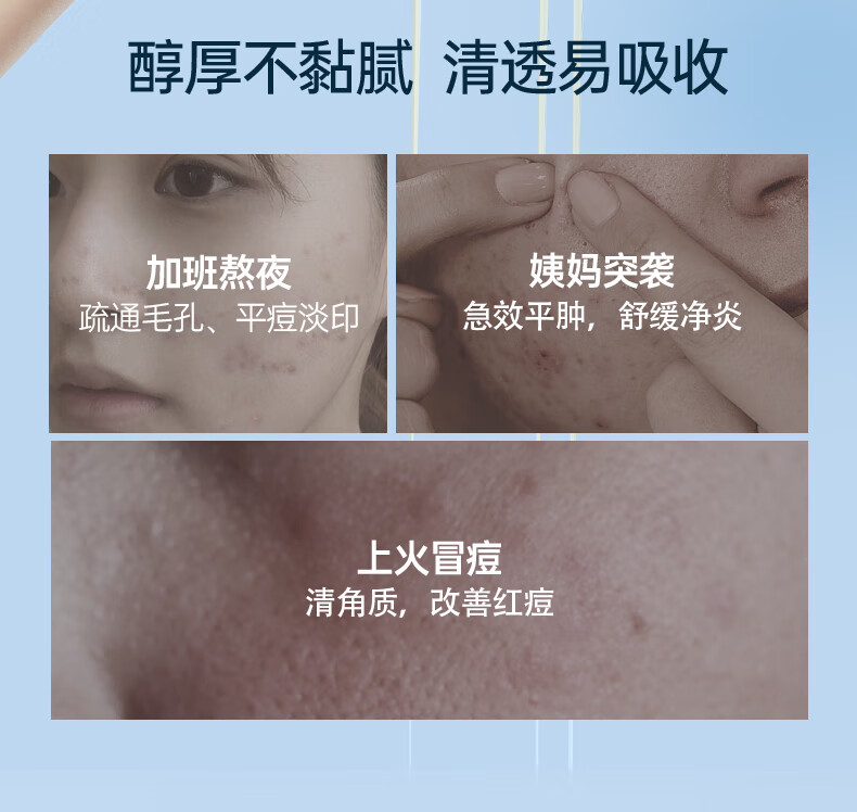 OHBT水杨酸精华液改善黑头闭口细致毛孔焕白靓白补水保湿淡化细纹呵护 【镇静舒缓】祛痘精华液50ml*2