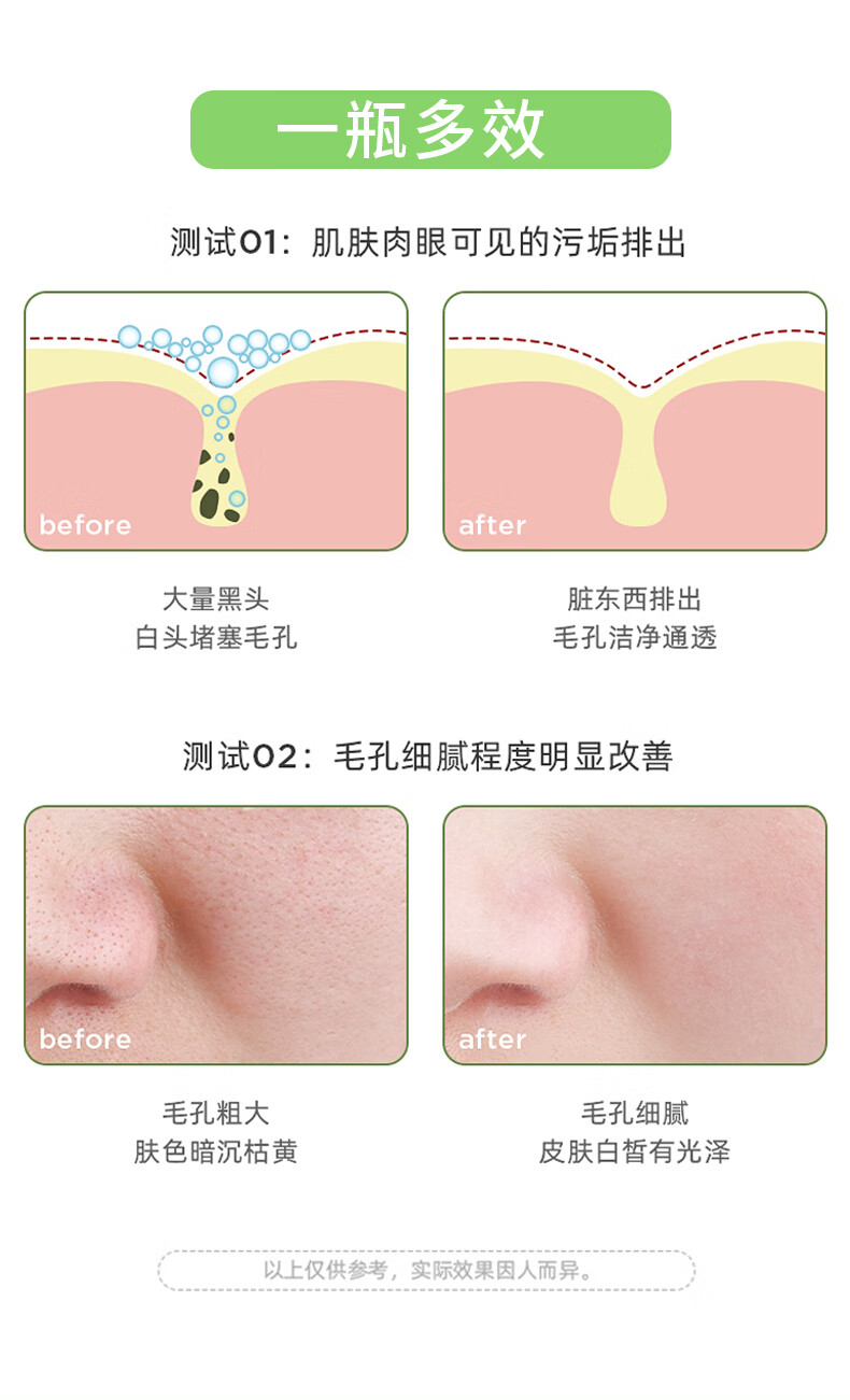 芷豆 茶树净透绿茶泥膜清洁面膜深层补水去黑头粉刺闭口收缩毛孔女 泥膜+凝胶