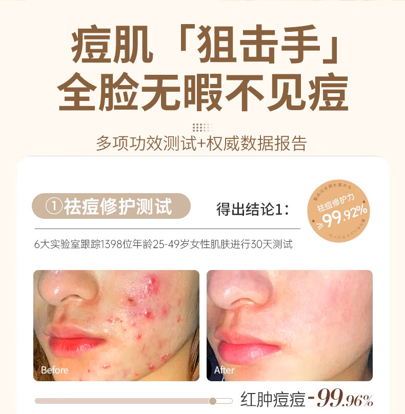 致朵祛痘霜膏修护淡化痘印痘坑去痘痘和痘痘印祛去粉刺青春痘30g/瓶