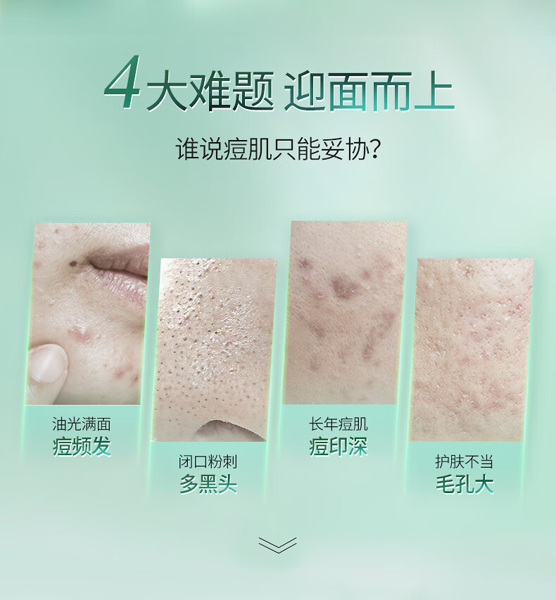 Thursday Plantation星期四农庄 澳洲进口 茶树金缕梅爽肤水100ml（平衡水油 收缩毛孔）