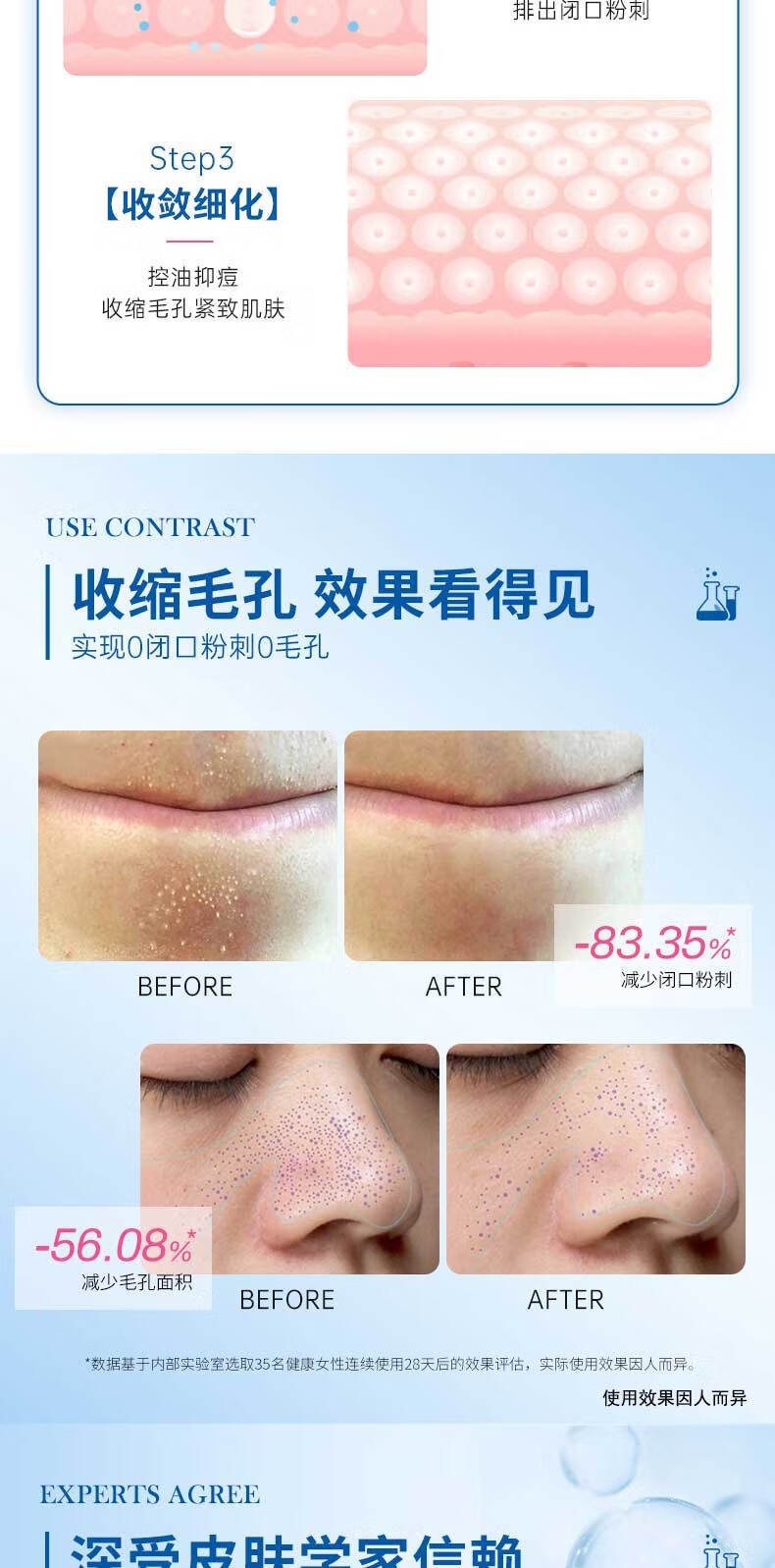 珂卡薇壬二酸15%凝胶水杨酸细致毛孔霜修颜凝露淡痘印黑头闭口粉刺30ml