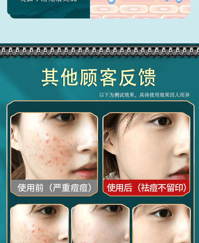 南京同仁堂祛痘膏淡化痘印痘疤痘坑呵护痘肌青春痘