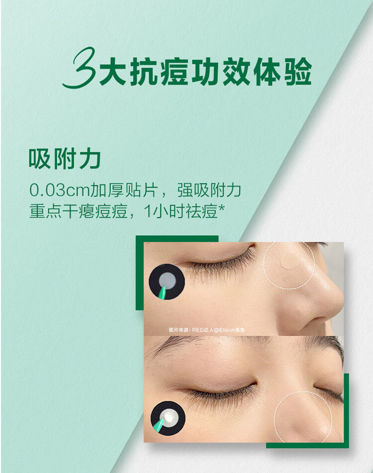 曼秀雷敦（Mentholatum）乐肤洁隐形痘贴 痘痘贴轻薄遮瑕可上妆吸脓抗痘 修护速吸26片