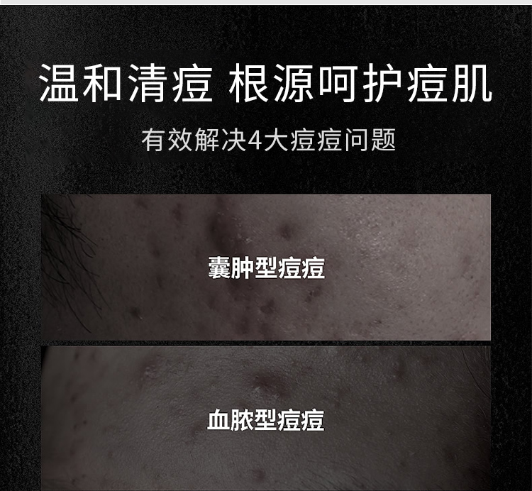 丁家宜男士寡肽精华原液淡化呵护痘印坑男女30ml去痘痘收缩毛孔补水精华
