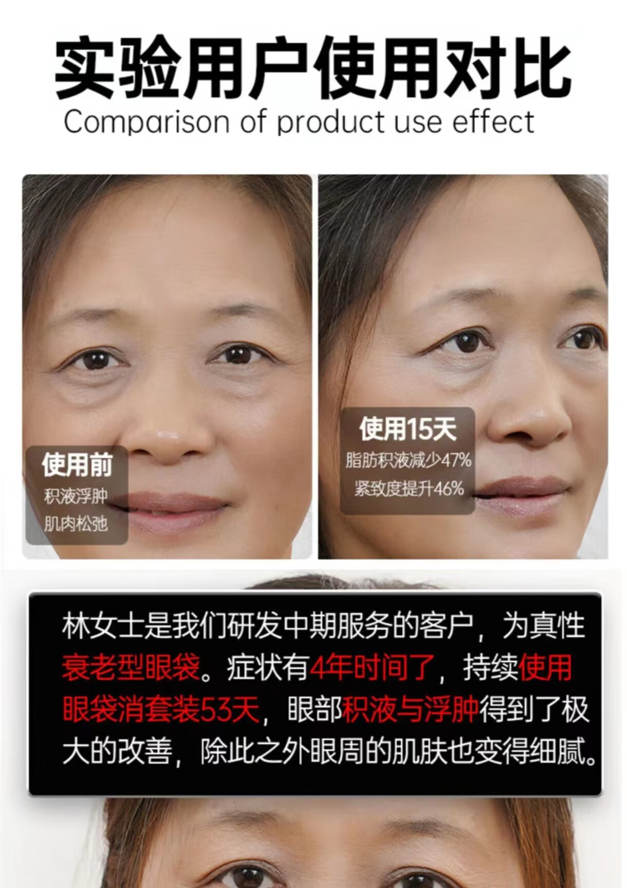 同仁堂类蛇毒眼霜眼袋黑眼圈淡化细纹皱纹提拉紧致补水保湿呵护眼周30g