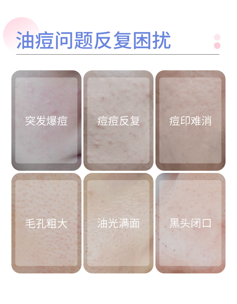 芙清密钥 10%壬二酸精华乳祛痘控油补水保湿粉刺清洁乳液 【控油祛痘】壬二酸5g*2