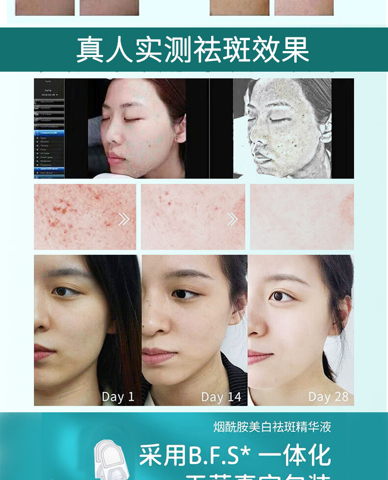 花姬赏白云山烟酰胺原液补水美白淡斑祛斑次抛精华液祛斑黑色素产品15ml