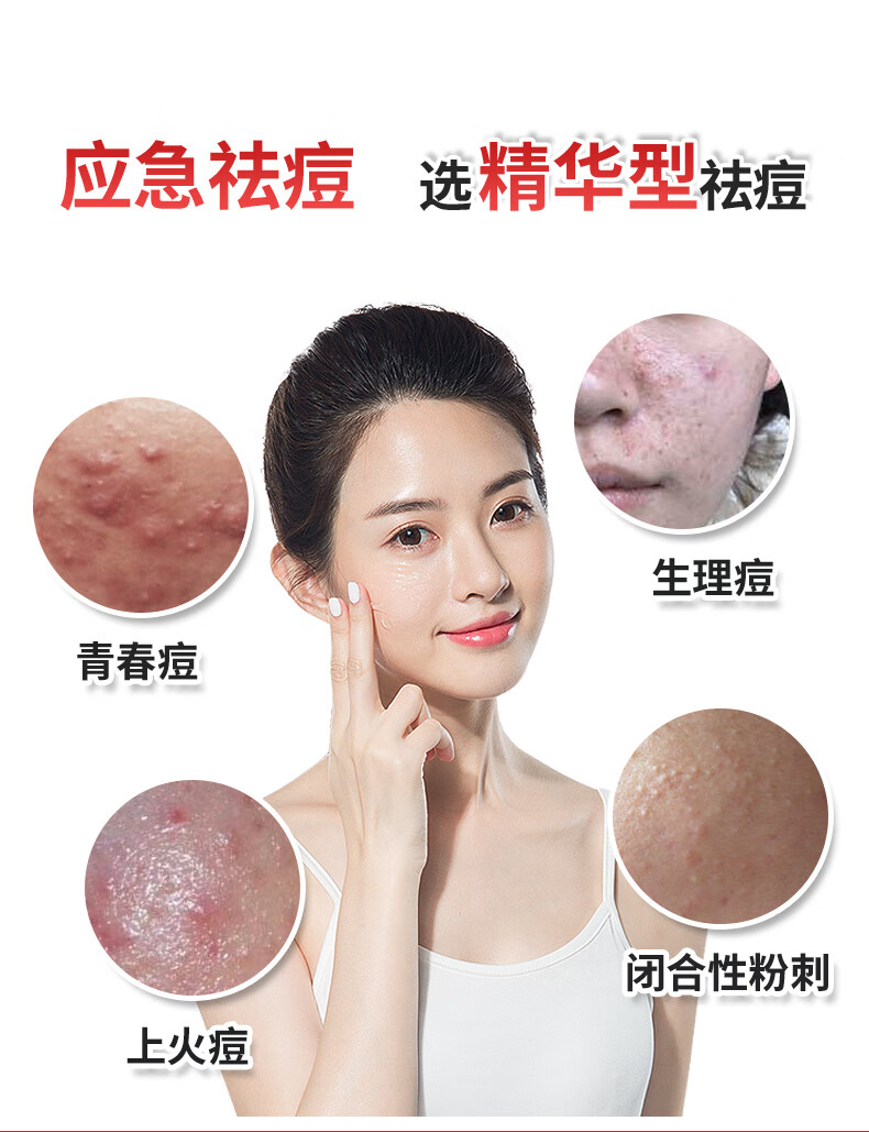 德德维芙（DETVFO）壬二酸15%祛痘凝胶淡化痘疤痘印痘坑改善黑头痘痘青春痘红肿痘闭口粉祛痘膏男女通用