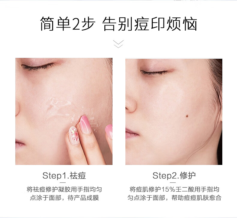 雅公主壬二酸15%凝胶水杨酸细致毛孔霜收缩毛孔任清洁黑头闭口粉刺30ml
