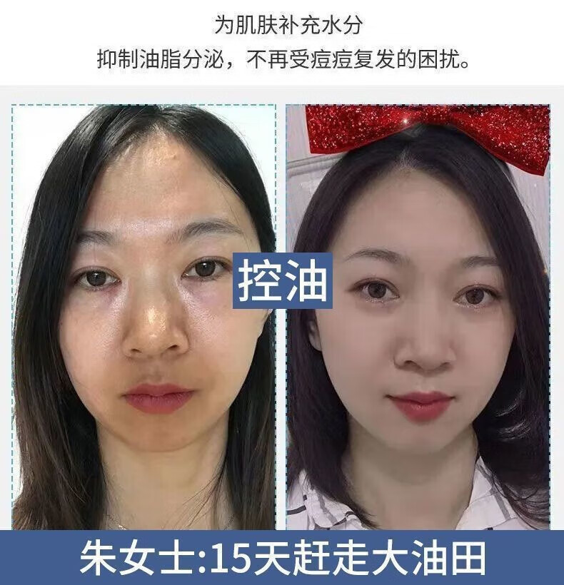 YMVLSD美白洗面奶烟酰胺净颜小野美白洁面乳博士控油改善暗沉亮肤洗面奶