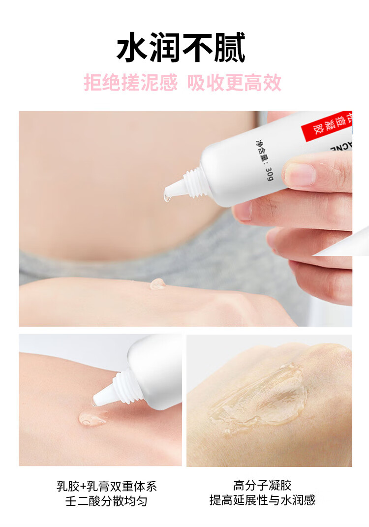 窈窕雅品 壬二酸15%凝胶和臻羞水杨酸软膏30g*2套装祛痘膏淡化痘印清痘凝露去黑头乳膏