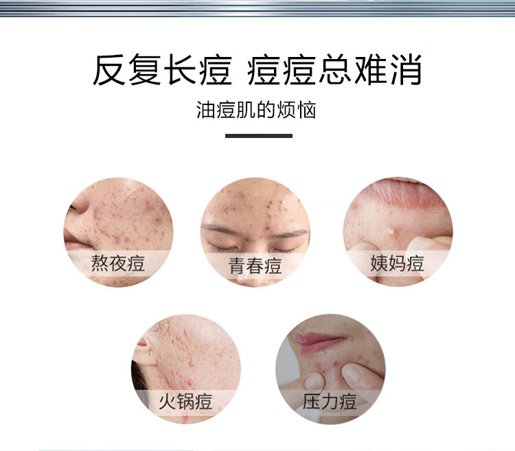 白云山祛痘膏痘印痘坑闭口粉刺油皮丹参芦荟祛痘凝胶男女通用30g
