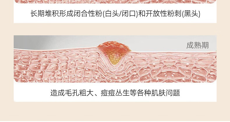芳丹薄罗去黑头乳糖酸撕拉式面膜深层清洁毛孔吸黑头粉刺鼻贴涂抹式男女