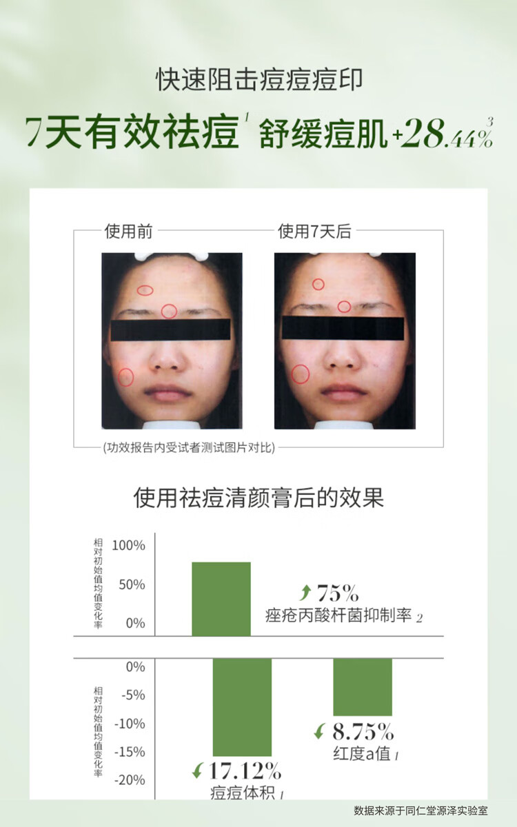 同仁堂（TRT）祛痘膏祛修复淡化痘印痘坑去痘痘和痘印膏痕疤20g