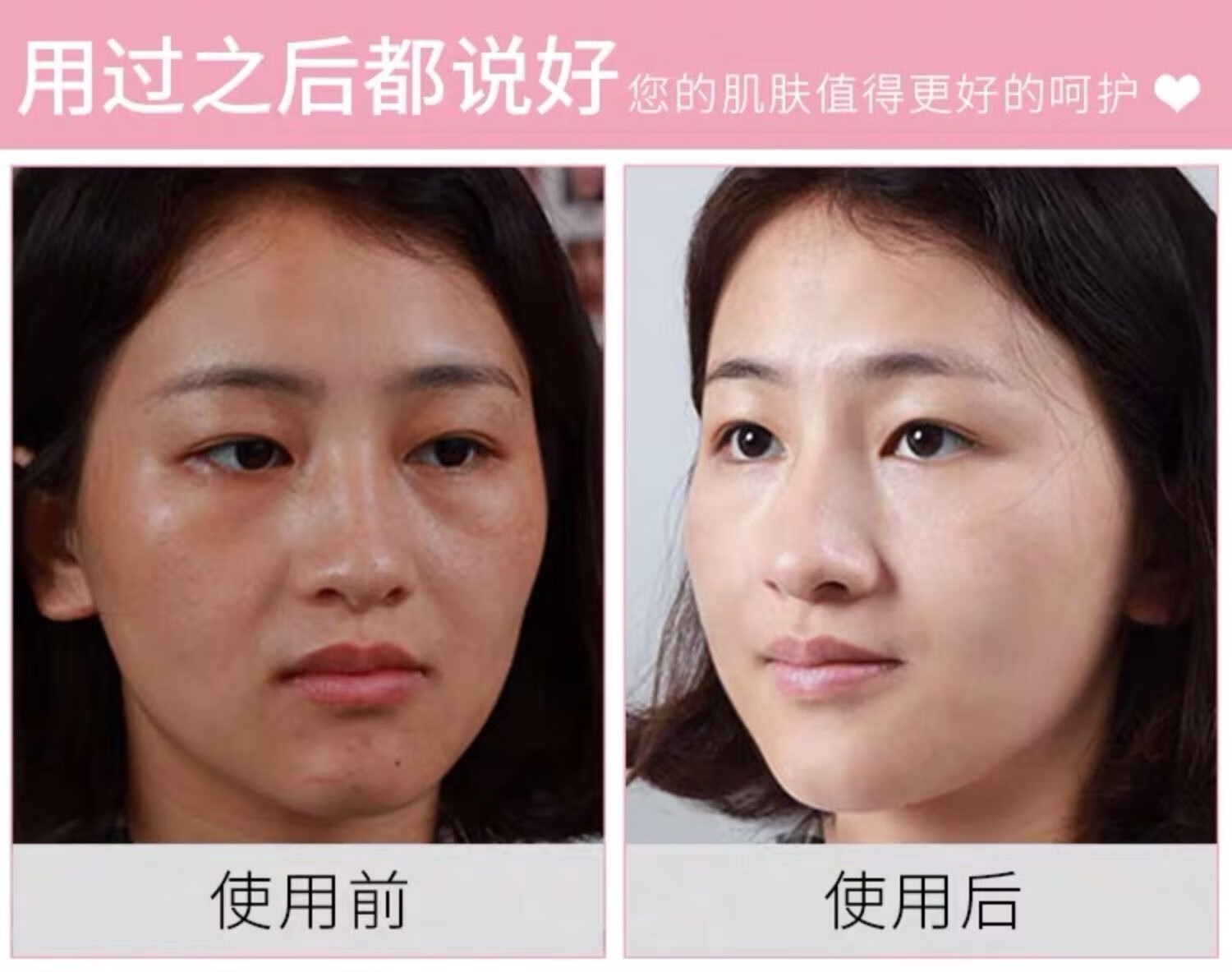 RUTBELL美白祛斑精华油提亮肤色淡化晒斑雀斑黄褐斑老年斑面部精华液 1瓶【建议按疗程购买】