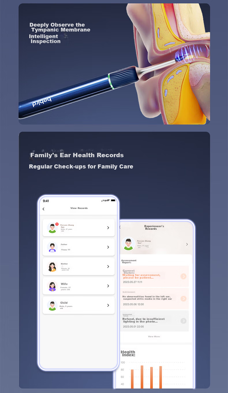 Bebird Note5 Умный визуальный инструмент для чистки ушей, устройство для чистки ушей, пинцет, инструмент для осмотра ушей, цвет "Ледниковый белый"