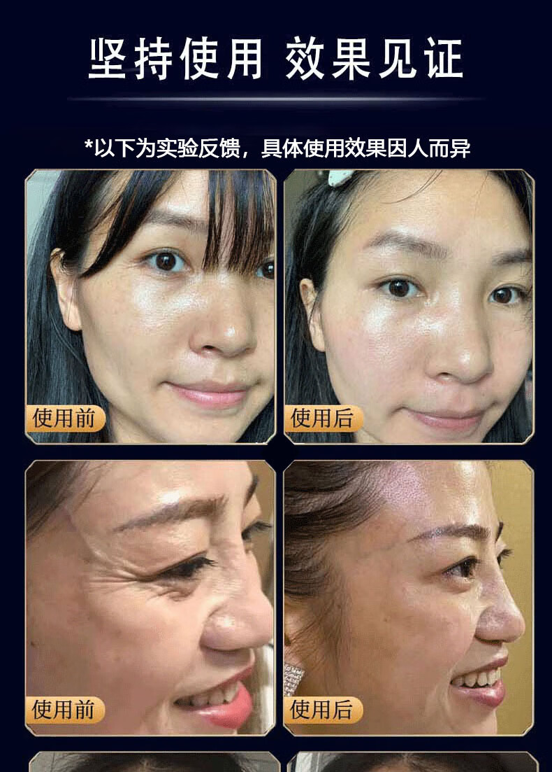 广药白云山类蛇毒肽眼霜淡化细纹脂肪粒抗皱纹提拉紧致眼霜黑眼圈男女士30g