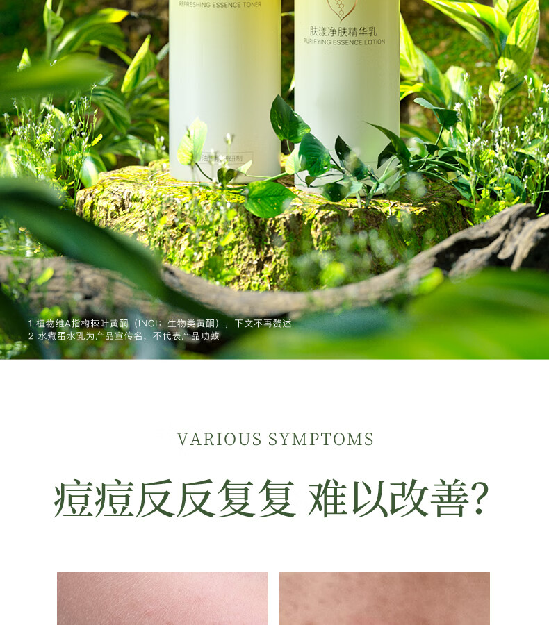 肤漾（Foryon）油痘肌水乳护肤品套装男女氨基酸洁面爽肤水乳液油皮控油抗痘 轻肌水100ml+净肤乳50g