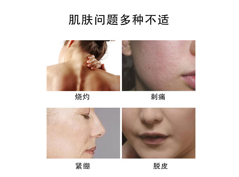理肤泉特安舒复修护乳40ml补水保湿舒缓泛红修复屏障乳液轻盈面霜护肤品