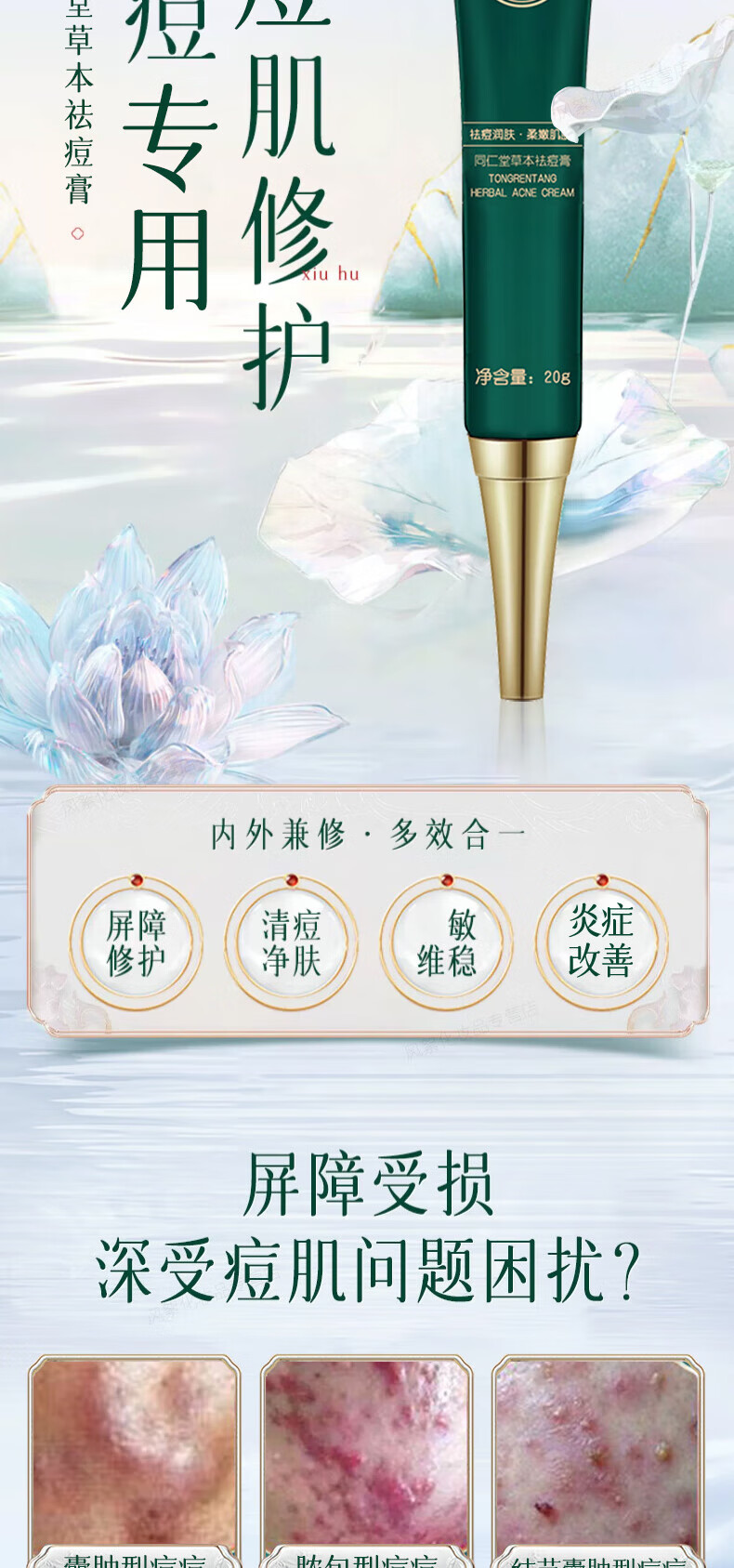 同仁堂祛痘膏淡化痘印痘坑修复男女士改善粉刺闭口去痘痘和痘印