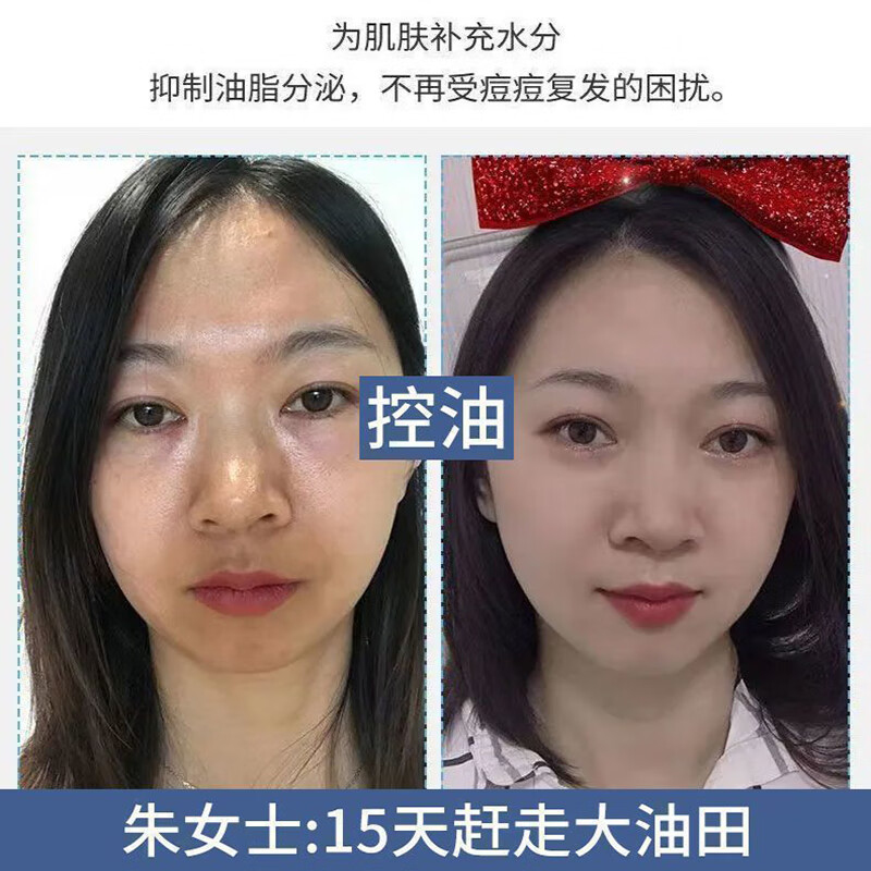 国药精养氨基酸洗面奶男女士除螨控油去黑头深层清洁补水保湿美白洁面乳