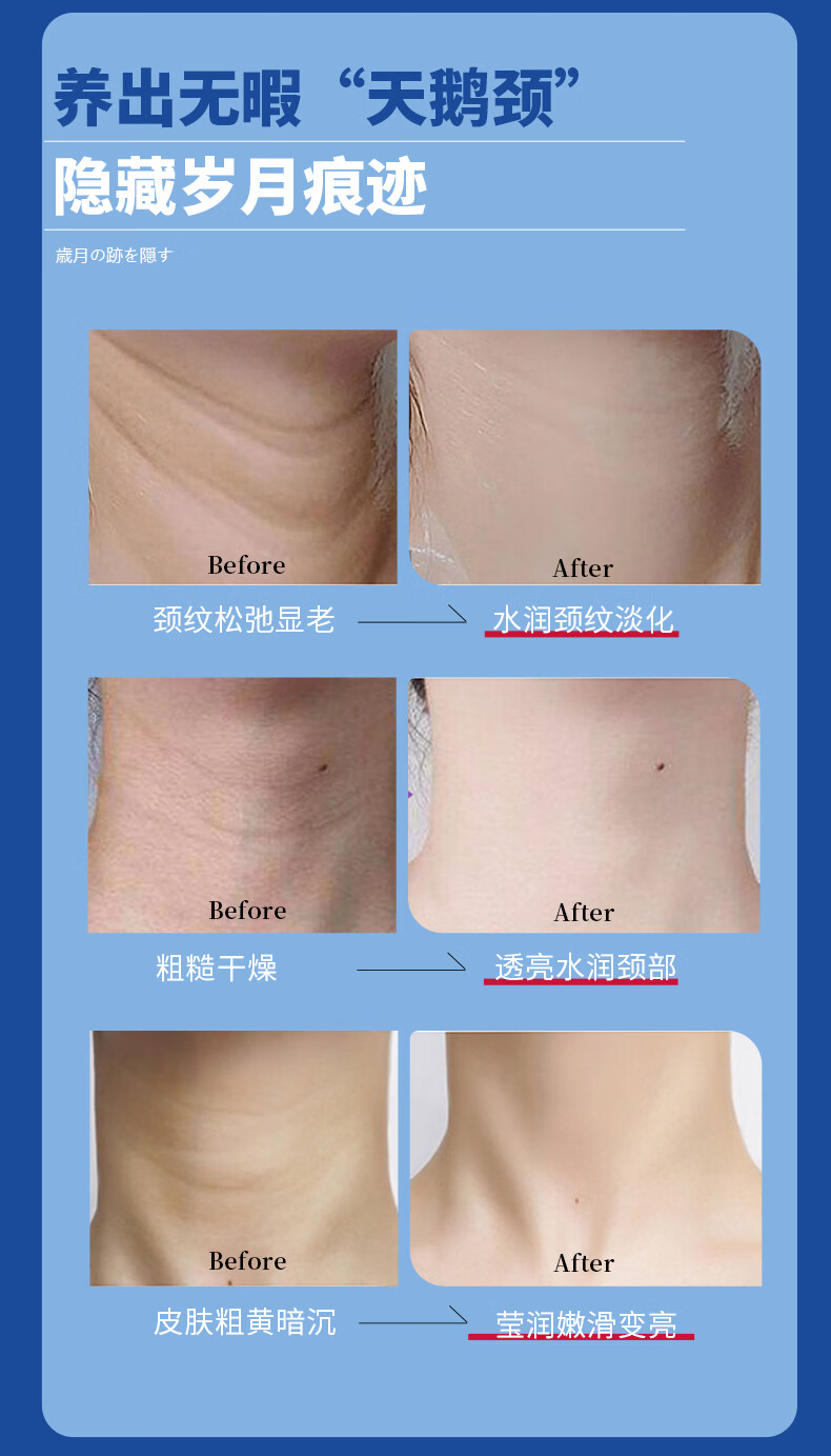 倩滋（QIANZI）多肽胶原蛋白抗皱颈膜20ml*10片/盒修护脖子面膜补水颈部护理女