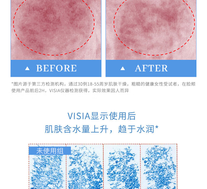 beauty notes玻尿酸补水喷雾保湿控油清爽舒缓爽肤水化妆水湿敷水补水保湿