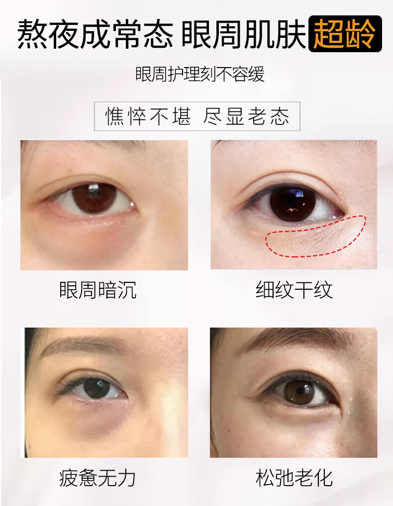 SKIK黑眼圈眼部紧致抗皱精华油眼i霜A醇淡化黑眼圈眼袋眼细纹泪沟 3支装【黑眼圈眼袋使用】