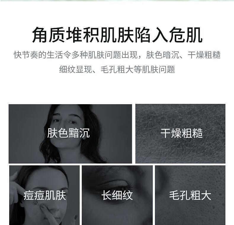 Tondi芦荟胶补水保湿痘印坑凝胶晒后呵护女男士300ml