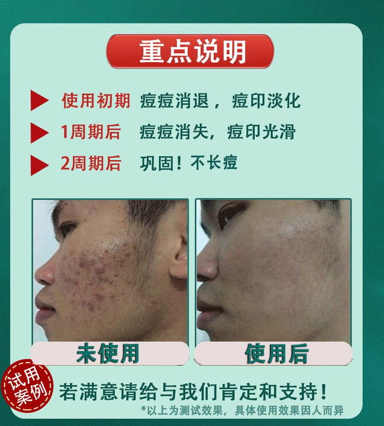 南京同仁堂祛痘膏淡化痘印痘疤痘坑呵护痘肌青春痘
