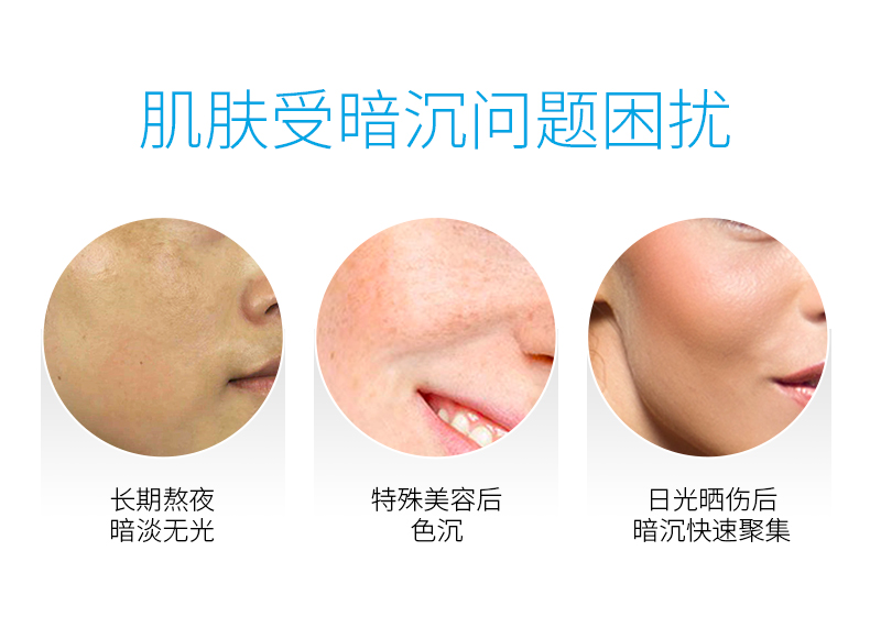 优斐斯（uface）传明酸+烟酰胺精华液双子星套装 提亮肤色改善暗沉礼物礼盒