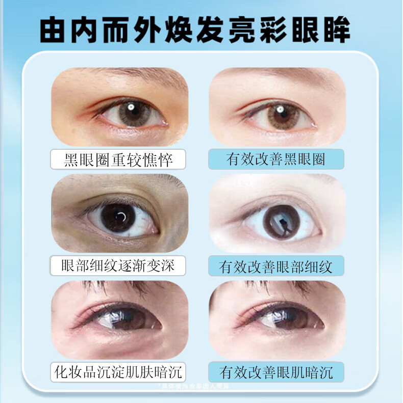 sakose凡士林蛇毒抗皱紧致眼膜贴60片/罐 淡化细纹眼袋黑眼圈提拉保湿