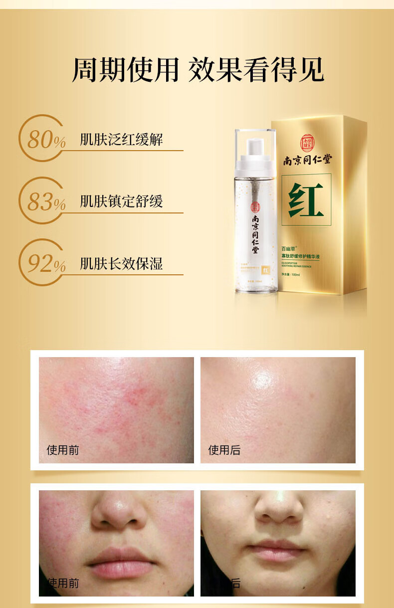 南京同仁堂红血丝寡肽舒缓修护精华液敏感肌可用高原红角质层薄补水保湿精华喷雾100ml
