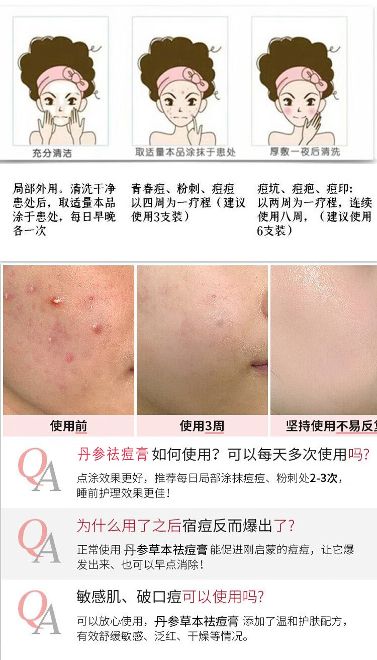 南京同仁堂祛痘膏芦荟祛痘凝胶收缩毛孔闭口粉刺淡化痘印痘肌男女青春痘20g