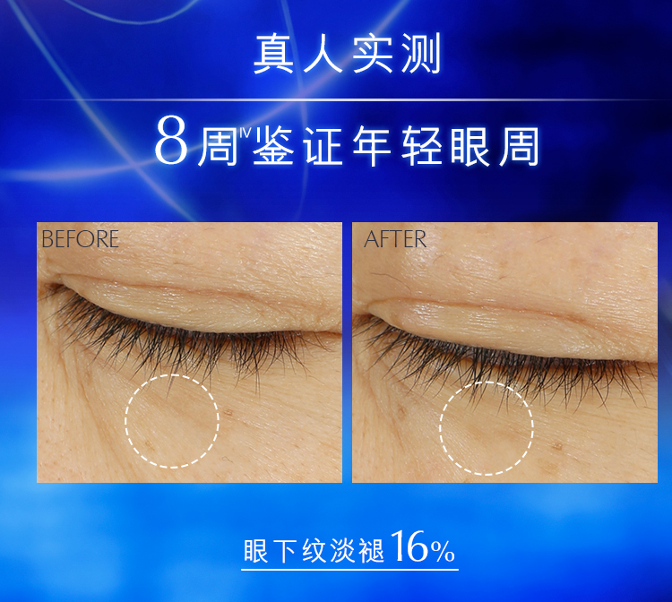 雅诗兰黛（Estee Lauder）特润修护精华眼霜5ml*3 淡化黑眼圈【美妆专享】