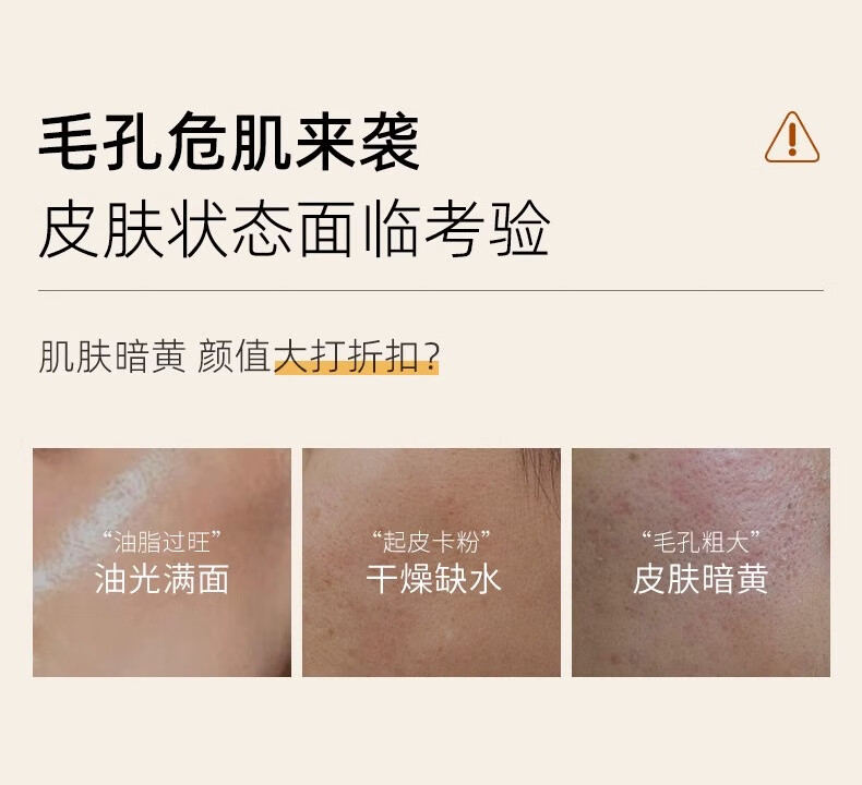 HORNCOS乳糖酸毛孔净透水爽肤水去黑头收缩毛孔面部补水湿敷化妆水380ml