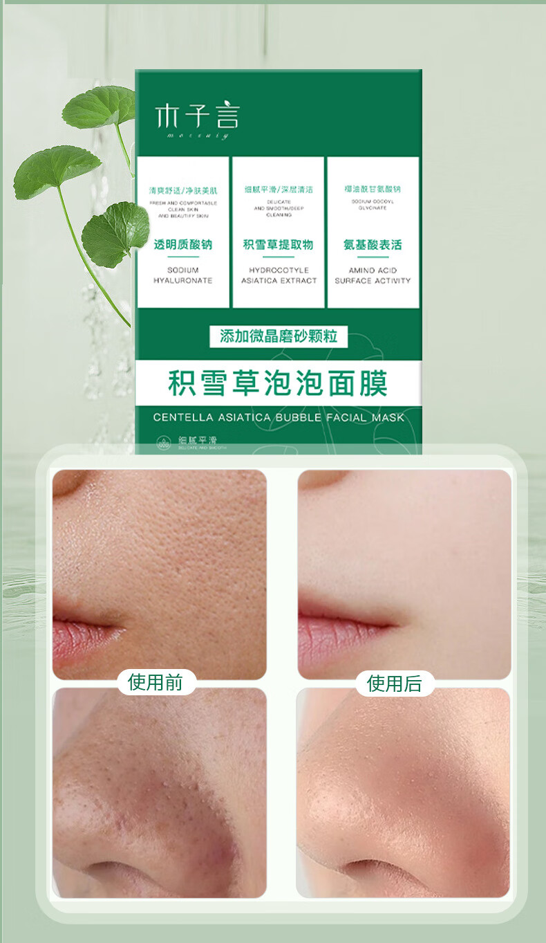 珂卡薇积雪草泡泡面膜去黑头毛孔收缩闭口清洁深层涂抹面膜男女48g