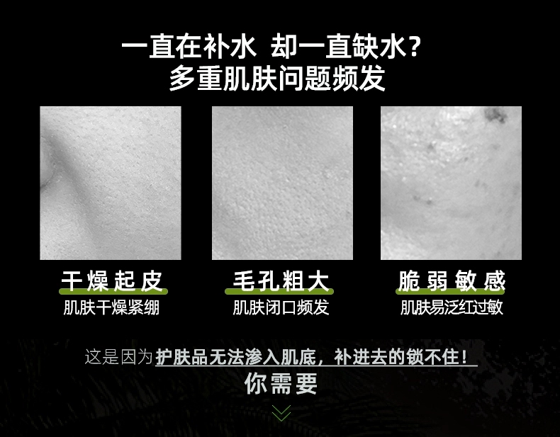 春夏南非复活草恒润保湿原液水(清爽型)60mL(润肤男女平价护肤品）