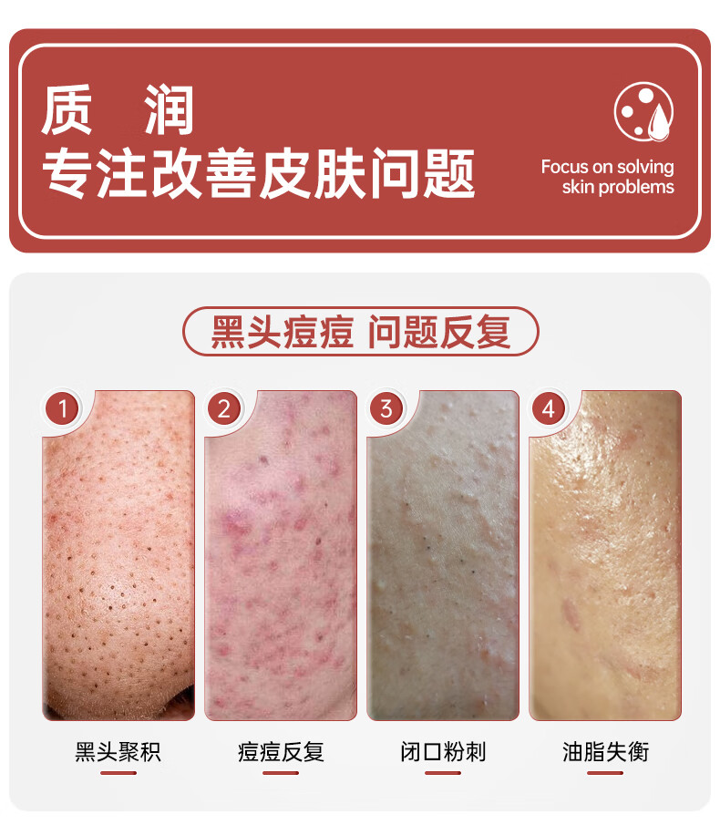 质润水杨酸祛痘棉片刷果酸细致毛孔去角质去黑头疏通清洁毛孔 30片*1