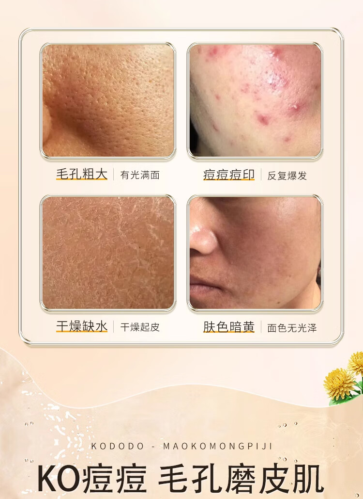 名蔻（MINGKOU）金盏花爽肤水补水保湿水湿敷收缩调解水油平衡毛孔男女通用500ml