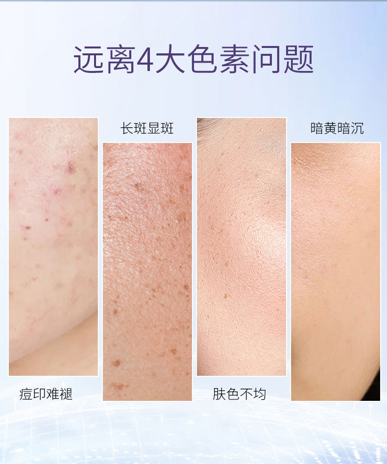 希芸臻白美白护肤品套装礼盒【美白特证】化妆品套装祛斑提亮送母亲