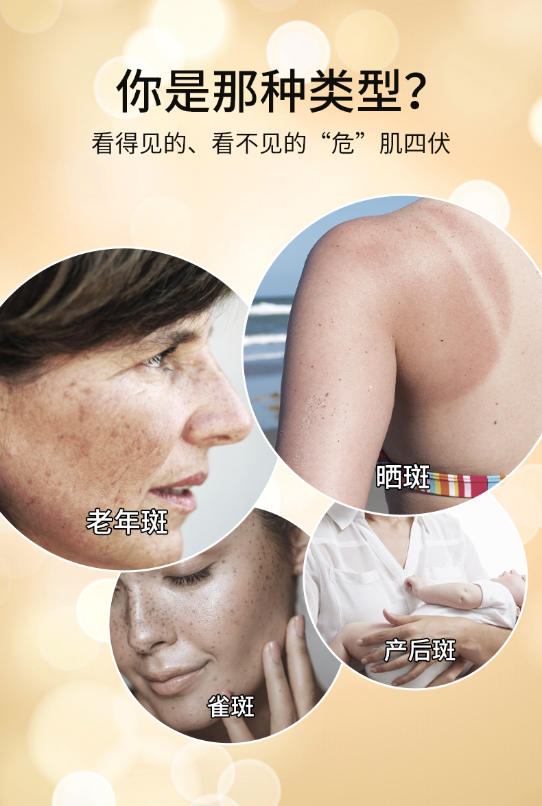 澜笛若慕（ANDORHEAL）肤研美白祛斑精华液玻尿酸烟酰胺原液小分子5%祛黄亮肤淡化黑色素