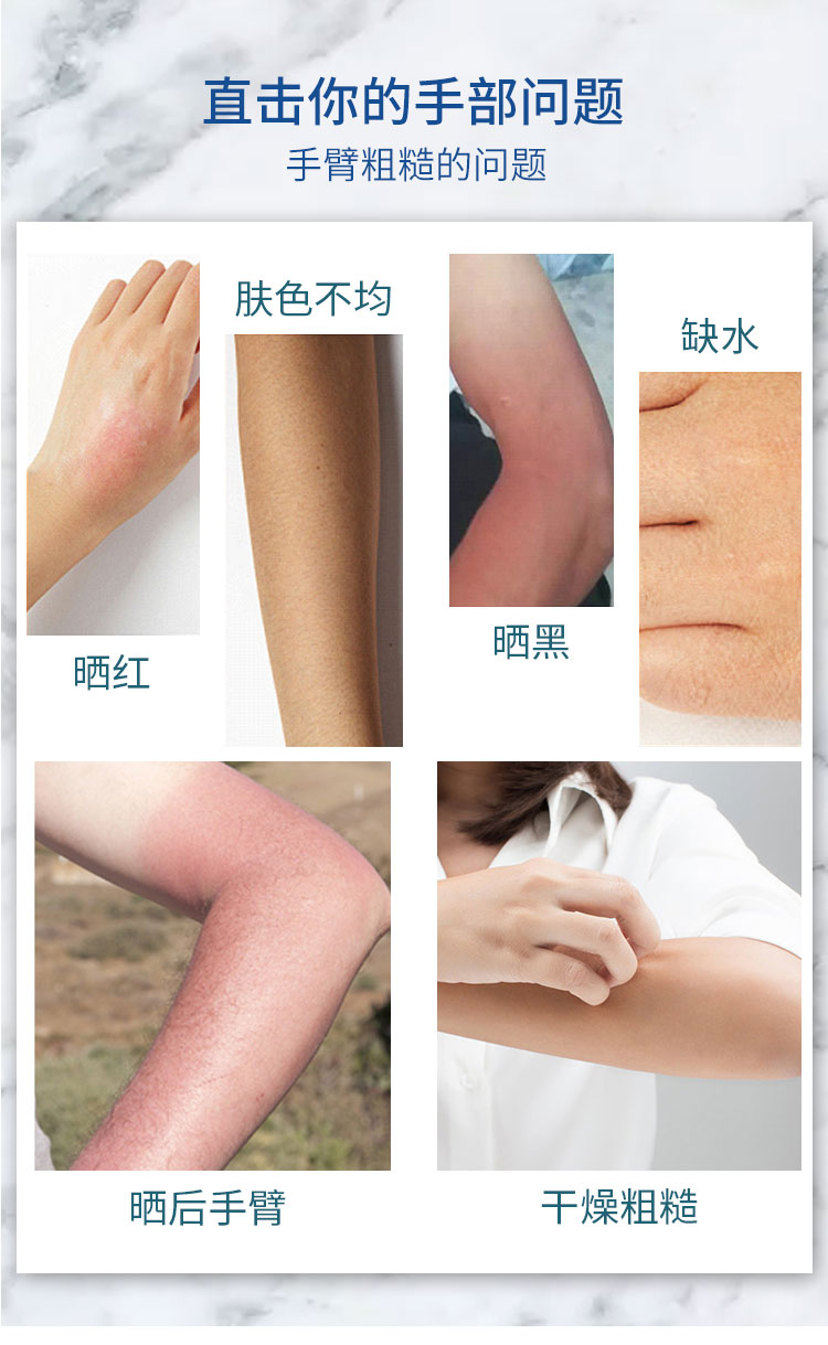 sakose凡士林浸润滋养手臂膜共5对 嫩滑补水保湿长款淡化细纹护手霜 