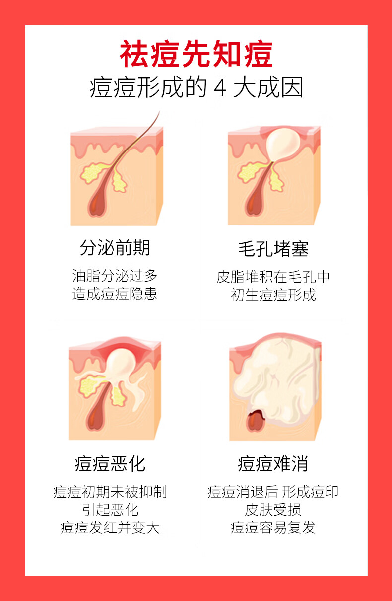 RYDEEN 壬二酸祛痘膏水杨酸净痘膏平衡痘肌痘坑熬夜助手学生党平价 三支装