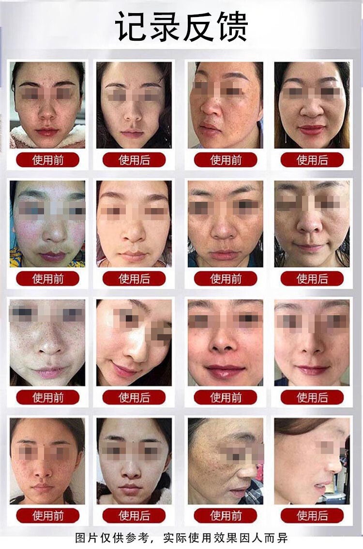 南京同仁堂美白祛斑精华液去斑淡化斑精华原液去老年斑黄褐斑妊娠斑祛斑产品男士女士用 100ml