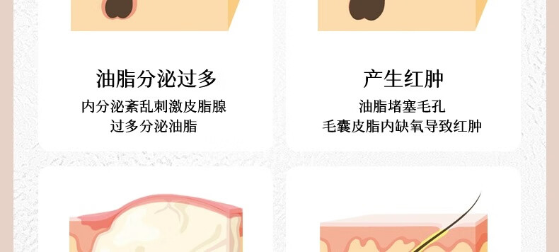 ORGINESE欧橘水杨酸果酸水滴精华液熬夜刷可搭祛痘淡化痘印20ml情人节