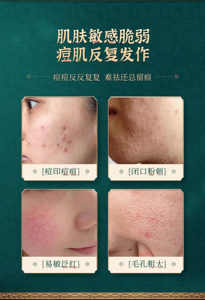 广药白云山祛痘膏淡化痘印草本茶树祛痘青春痘闭口粉刺抗痘祛痘凝胶女30g