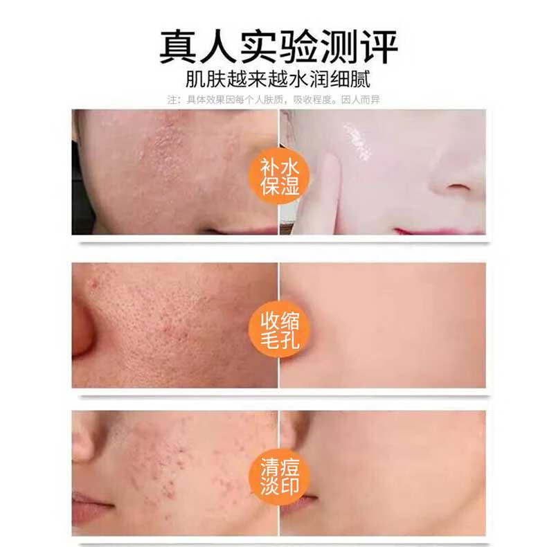 人仁和匠心收缩毛孔爽肤水金盏花精华水保湿补水抗痘毛孔粗大黑头调节水油平衡男女通用