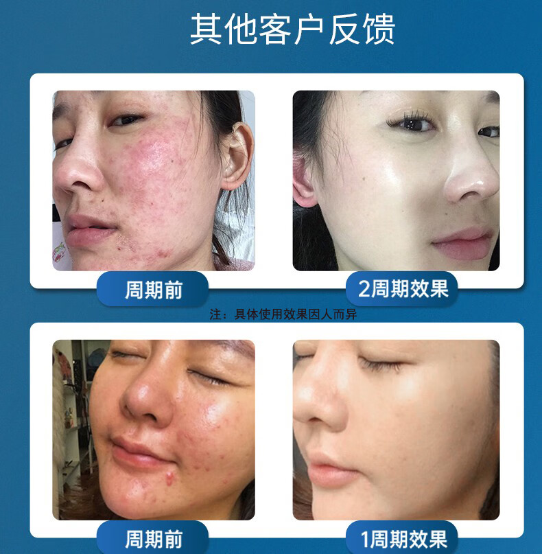 同仁堂氨基酸洗面奶水杨酸抗痘净螨收缩毛孔黑头烟酰胺深层清洁面乳200g