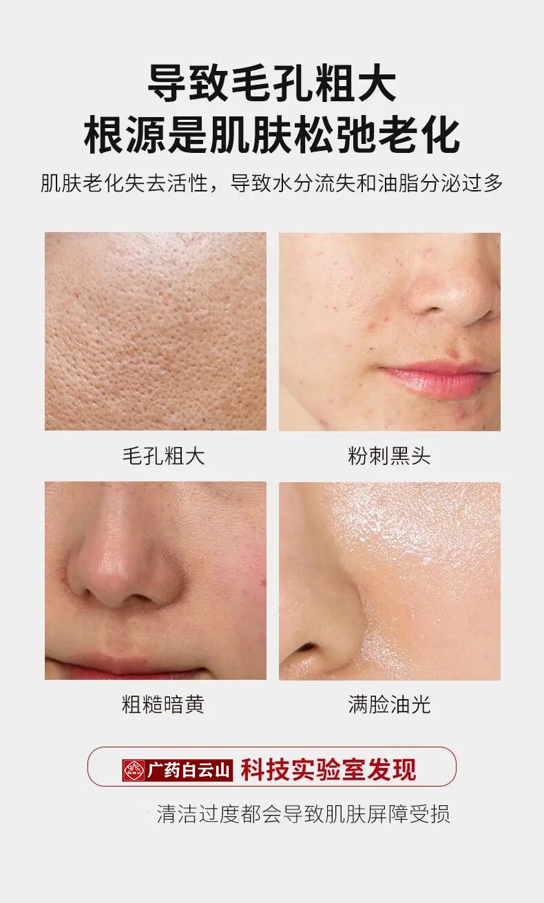 白云山星群 益生元爽肤水收缩毛孔精华水黑头毛孔粗大补水保湿嫩肤水180mL